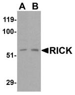 RIP2 Antibody in Western Blot (WB)