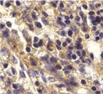 CXCR6 Antibody in Immunohistochemistry (IHC)
