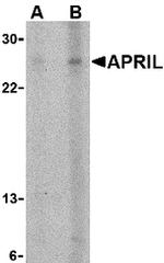 APRIL Polyclonal Antibody