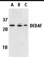 RYBP Antibody in Western Blot (WB)