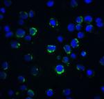 Acinus Antibody in Immunocytochemistry (ICC/IF)