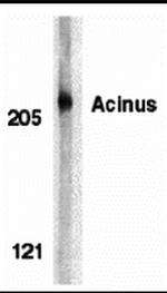 Acinus Antibody in Western Blot (WB)