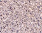 F1A alpha Antibody in Immunohistochemistry (IHC)