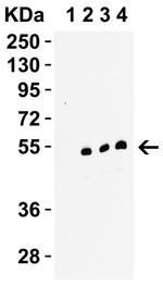 RIP3 Polyclonal Antibody