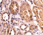BNIP3L Antibody in Immunohistochemistry (IHC)