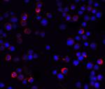 IKK gamma Polyclonal Antibody