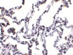 p53R2 Polyclonal Antibody