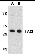 CD267 (TACI) Antibody in Western Blot (WB)