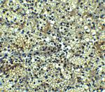 BCMA Polyclonal Antibody