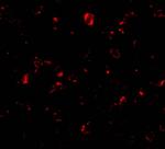 MTBP Antibody in Immunocytochemistry (ICC/IF)