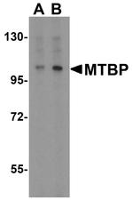 MTBP Antibody in Western Blot (WB)