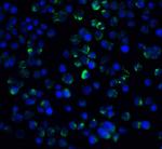 IL21R Polyclonal Antibody