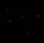 TCCR Polyclonal Antibody