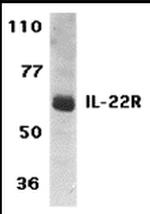 IL-22 Receptor alpha Polyclonal Antibody