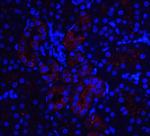 IL-22 Receptor alpha Antibody in Immunohistochemistry (IHC)