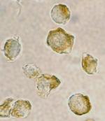 Nudel Polyclonal Antibody