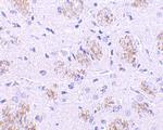 KLHL1 Polyclonal Antibody