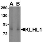 KLHL1 Antibody in Western Blot (WB)