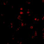 AATF Polyclonal Antibody