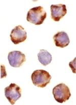 PUMA alpha Polyclonal Antibody