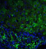 p53DINP1 Polyclonal Antibody