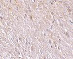 TTC5 Antibody in Immunohistochemistry (IHC)