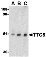 TTC5 Antibody in Western Blot (WB)