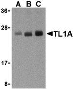TL1A Polyclonal Antibody