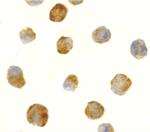 TEM8 Polyclonal Antibody