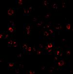 TEM8 Antibody in Immunocytochemistry (ICC/IF)