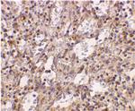 TLR2 Polyclonal Antibody