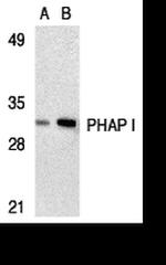 PHAP I Antibody in Western Blot (WB)