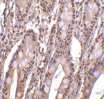 PHAP III Antibody in Immunohistochemistry (IHC)