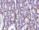 PHAP I Antibody in Immunohistochemistry (Paraffin) (IHC (P))