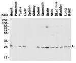 PHAP I Antibody in Western Blot (WB)