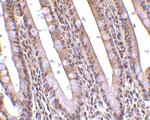 PHAP Polyclonal Antibody