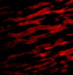 TIRAP Polyclonal Antibody