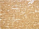 TIRAP Polyclonal Antibody
