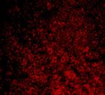 CARD11 Polyclonal Antibody