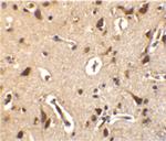 ALS2CR2 Polyclonal Antibody