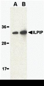 ALS2CR2 Antibody in Western Blot (WB)