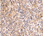 XAF1 Polyclonal Antibody