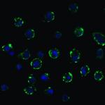 ACE2 Polyclonal Antibody