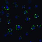 ACE2 Polyclonal Antibody