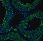 ACE2 Antibody in Immunohistochemistry (PFA fixed) (IHC (PFA))