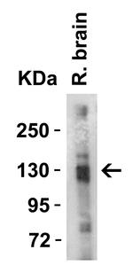 ACE2 Antibody in Western Blot (WB)