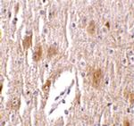 TRIM5 delta Antibody in Immunohistochemistry (IHC)