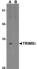 TRIM5 delta Antibody in Western Blot (WB)