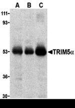 TRIM5 alpha Antibody in Western Blot (WB)