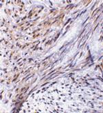 TRIM5 alpha Polyclonal Antibody